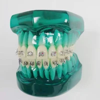dental m3001 orthodontic teeth model with metal bracketstudy practice model m3001 for dental labschool