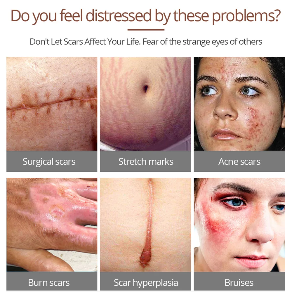 Восстановление крокодиловой кожи сывороточная эсенция корректор