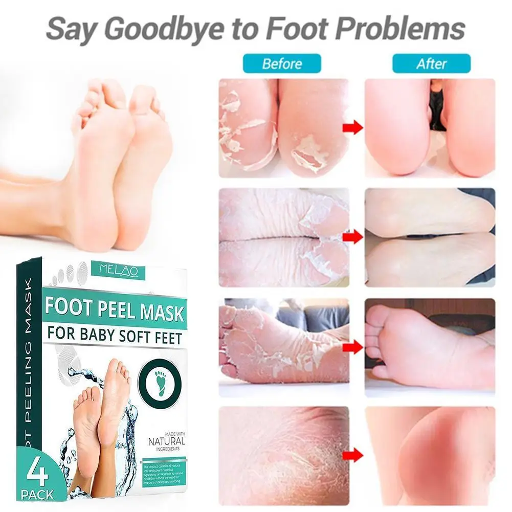 

1Bag=4pcs Exfoliating Foot Mask Socks For Pedicure Peeling Foot Removal Skin Health Care Feet Care Skin Socks Mask Dead For W0T9