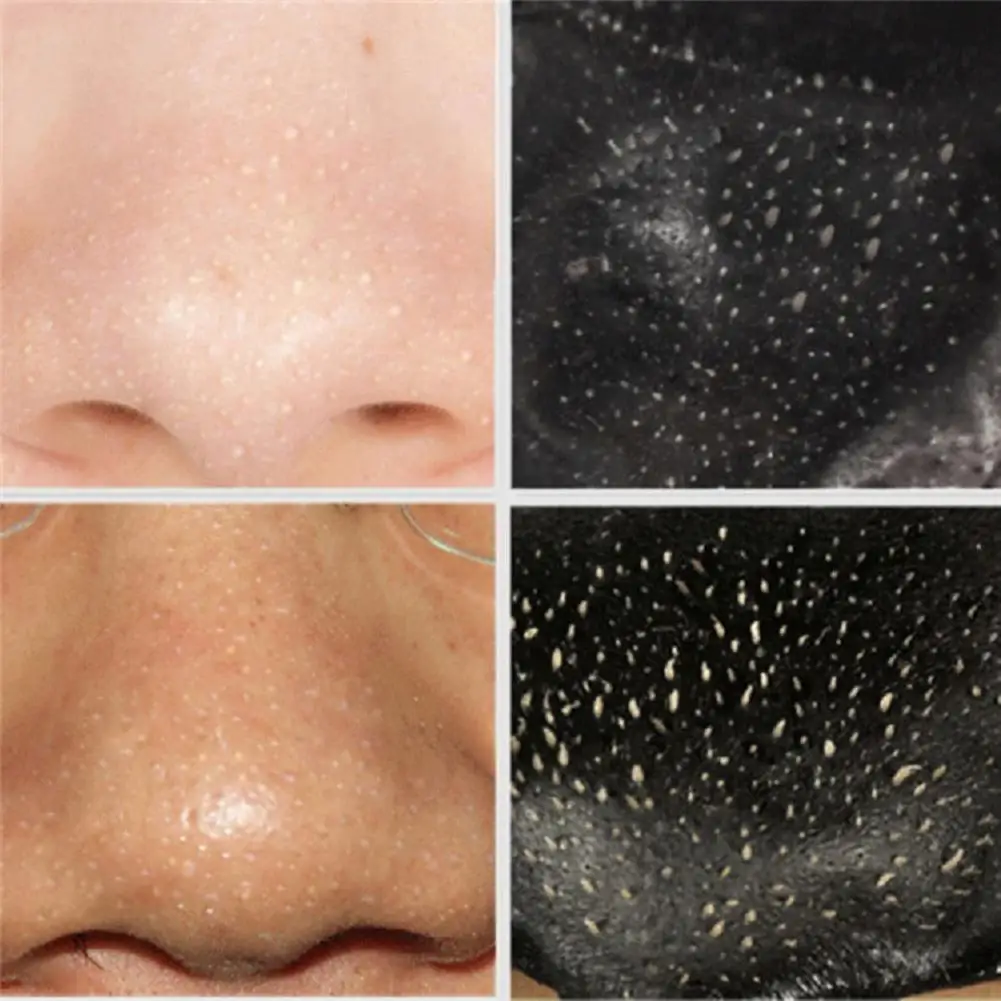 10 шт. маска для удаления черных точек|Средства ухода и маски| |