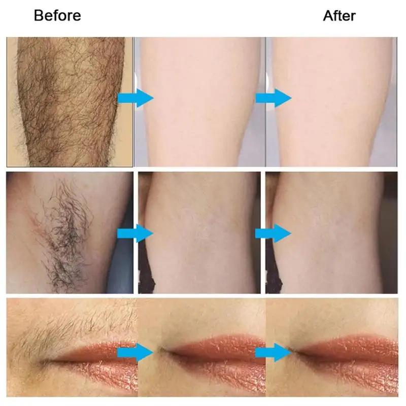 

Hair Removal Cream Permanent Stop Hair Growth Use For Face Removal Unisex Axillary Body Legs Hair Hair Pudendum Arms F9N2