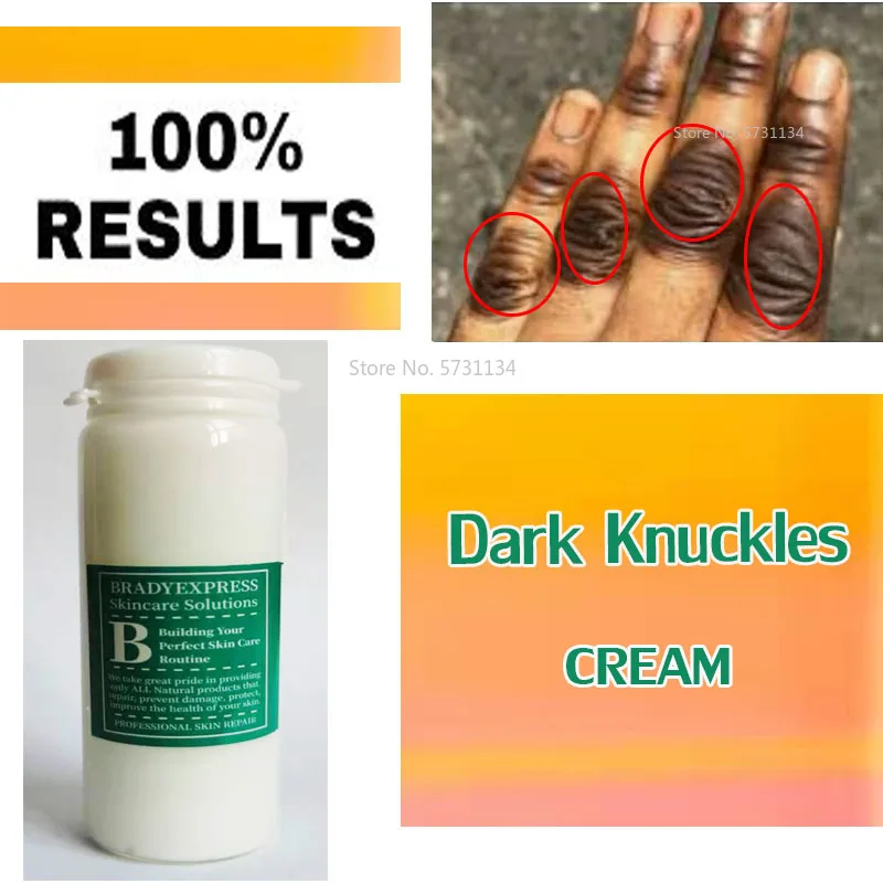 

Dark knuckles cream, Very Strong Cream , Dark Spots remover, Fast results