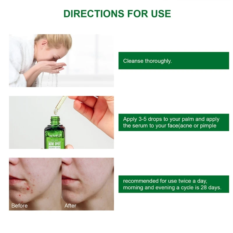 

17ml Acne Treatment Serum Tea Tree Clear Skin Serum For Clearing Severe Breakout Remover Pimple and Repair
