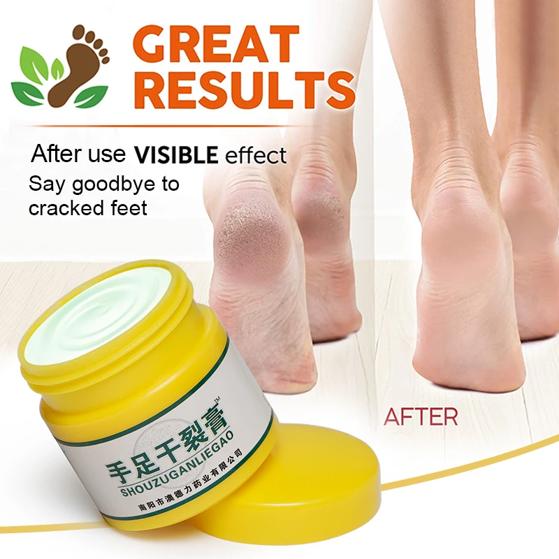 1 шт. от трещин на ногах крем по уходу за сухую потрескавшуюся каблуке ручной