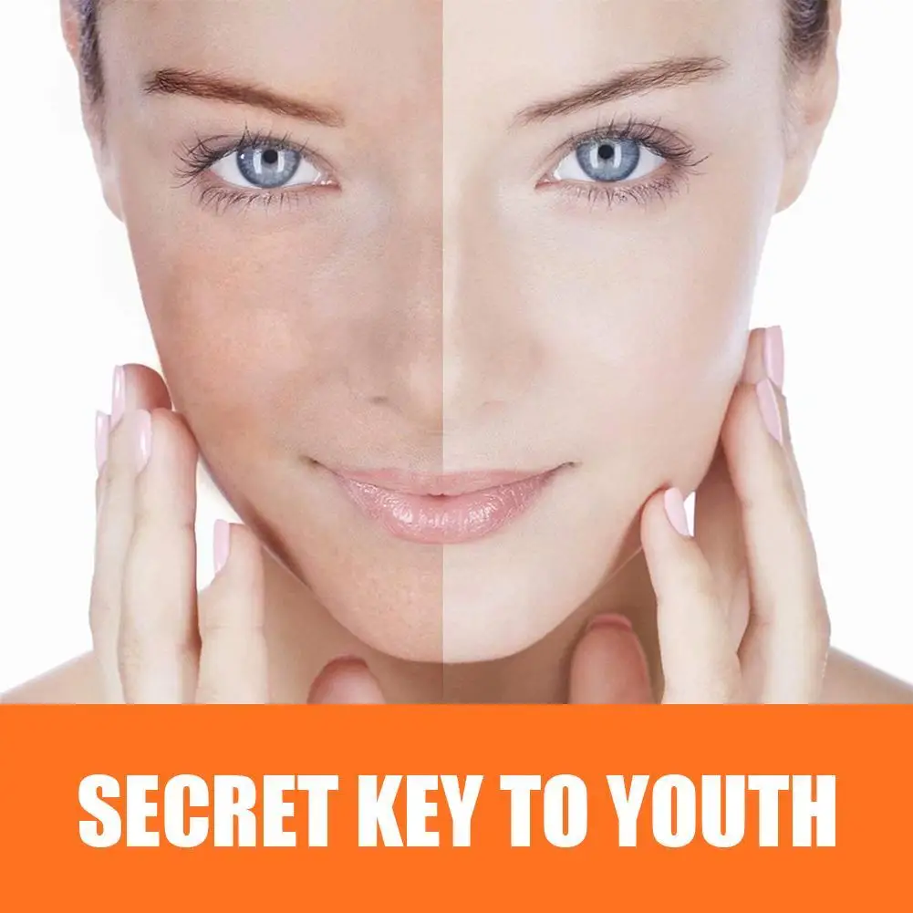 15 мл мощный крем для отбеливания веснушек удаление меласмы меланина пигмента