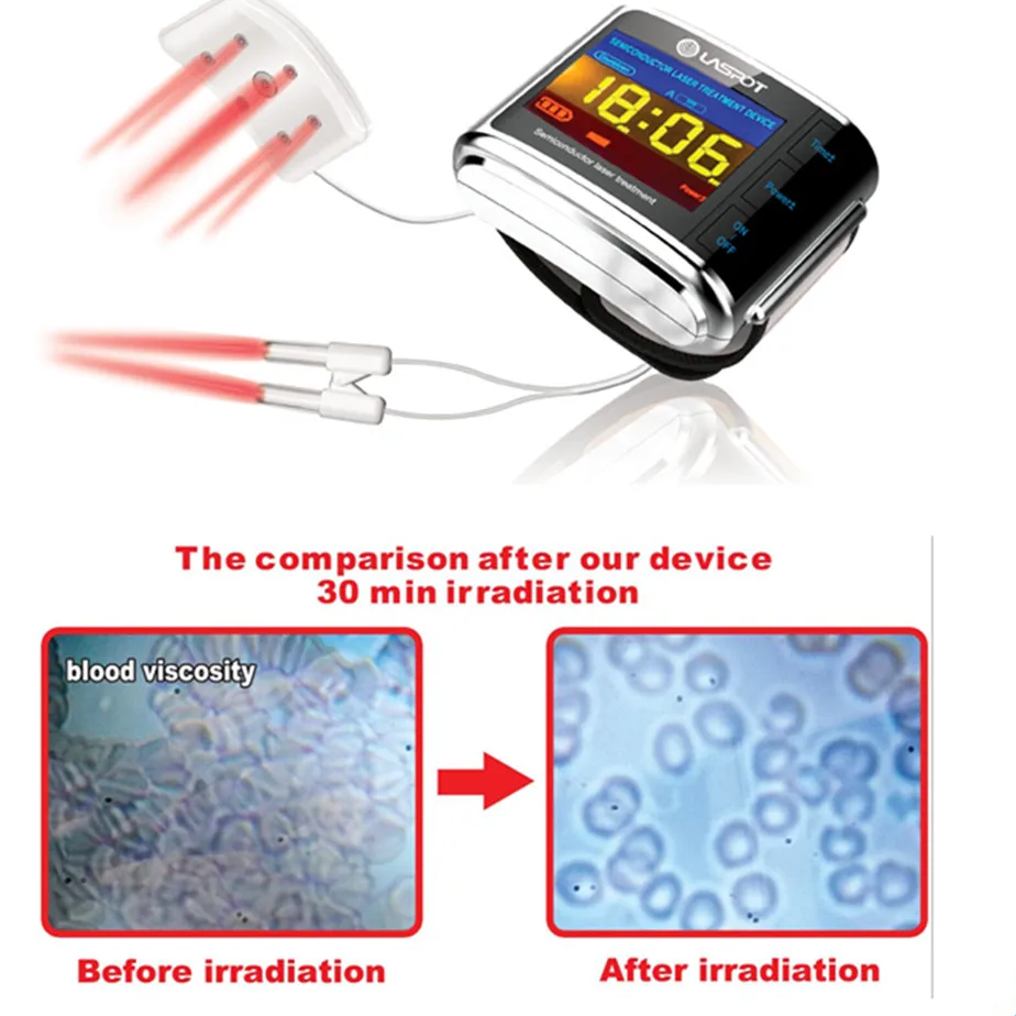 Красная лазерная холодная Лазерная низкоуровневая терапия Лечение для лечения