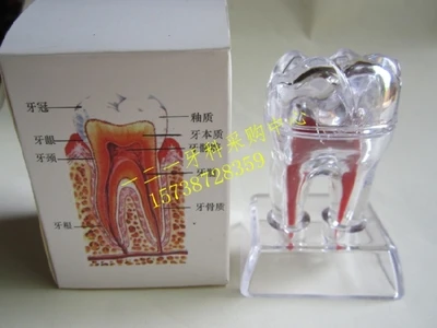 Dental Materials Removable Dental trinkets free shipping