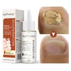 Эссенция для лечения Ногтей от грибков 20 мл Уход за ногами восстанавливающая сыворотка для ногтей Удаление грибка ногтей гель против инфекции паронихия онихомикоз