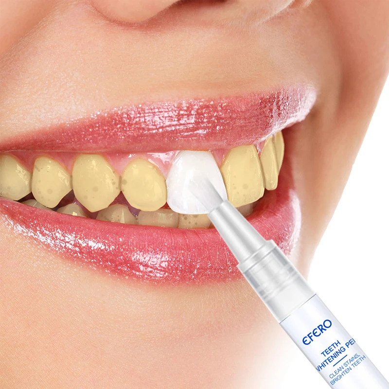 

Whitening Teeth Pen Serum Bleaching Plaque Stains Remove Teeth Cleaning Gel Whiten Brighten Teeth Whitening Pen Oral Hygiene