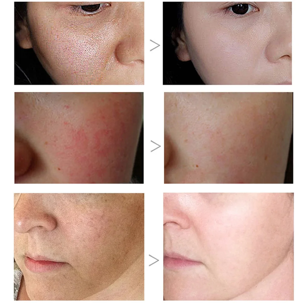 

Wholesale Green Tea Lough Pore Corset Serum Facial Essence Moisturizing Brighten Skin Care Oil Control M3