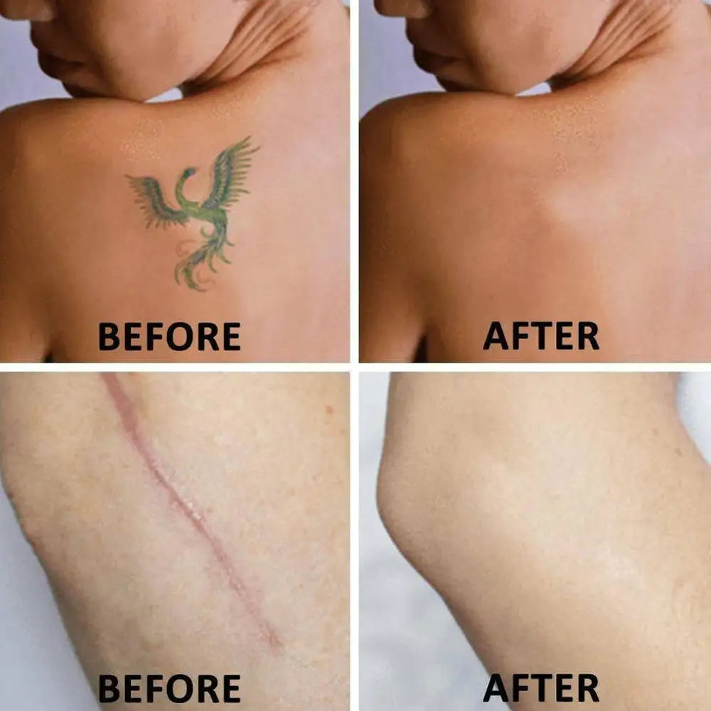 Супер невидимая лента для татуировок и шрамов 6 цветов оптовая продажа