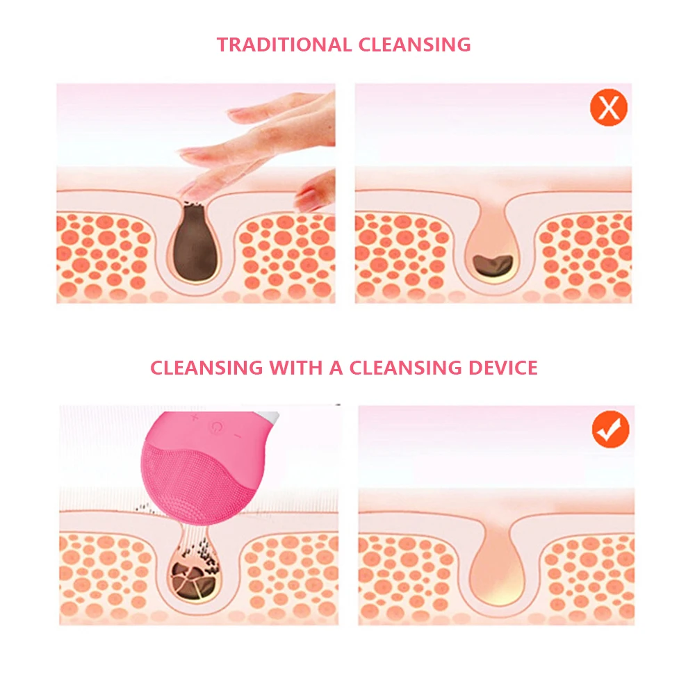 Силиконовый массажер для лица электрическая Очищающая щетка средство удаления