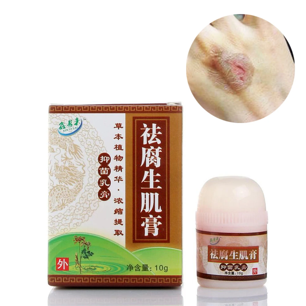 Травяная восстанавливающая мазь для кожи крем ран Сливочная паста лечения язв от