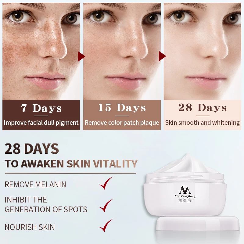 Мощный крем для отбеливания веснушек 40 г удаления пятен от акне пигмент меланин