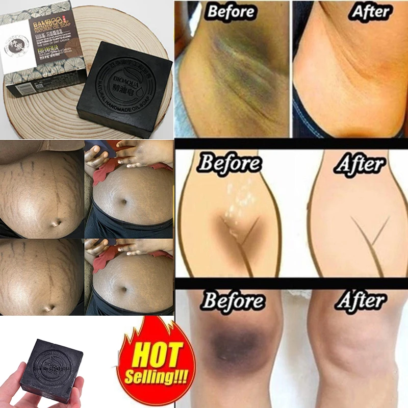 

100g Use The Physical Properties of Bamboo Charcoal To Whiten Intimate Privacymild Non Irritating Can Be Used By Pregnant Women