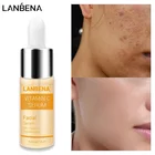 Витамин C отбеливающая лицевая сыворотка Care осветляющие пятна осветляющие кожу лица эссенция для кожи выцветают темные пятна удаляют веснушки Speckle Product