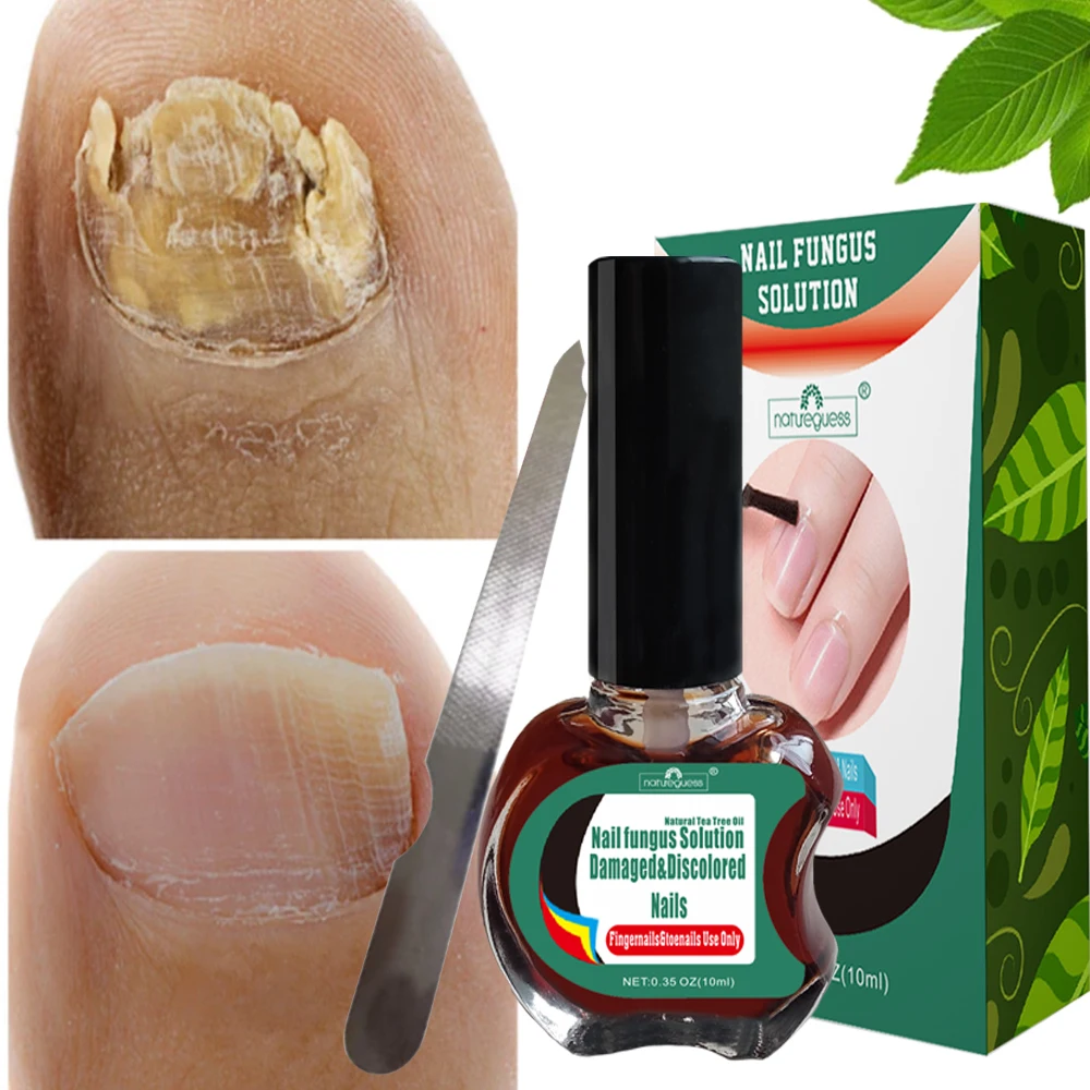 Противогрибковая Сыворотка для ногтей уход восстановление эссенция паронихия