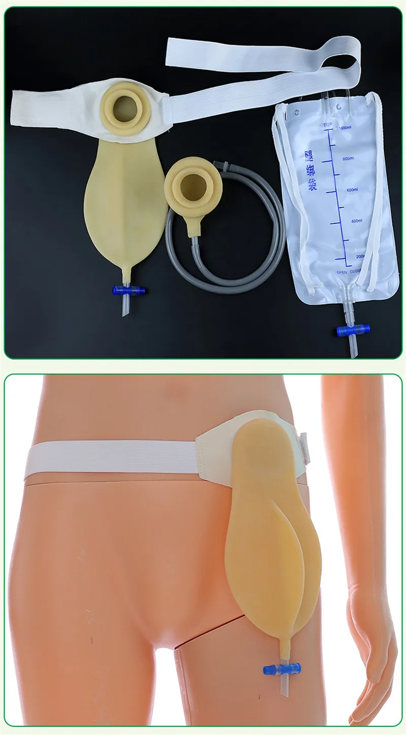 Wetips силиконовые многоразовые Стома мочеприемник писсуар Портативный мочевой