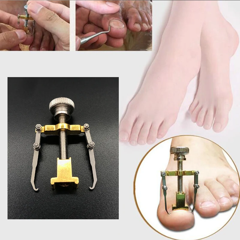 Бактериальные инструменты для ног ортопедический корректор ногтей|care tool|bunion