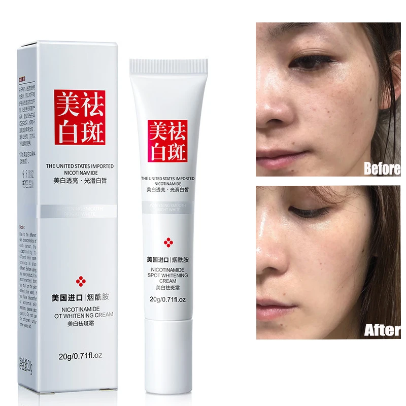 

Whitening Face Cream Moisturizing and Brightening Skin Remove Freckles and Dark Spots 20g Repair Facial Skin Care Cream