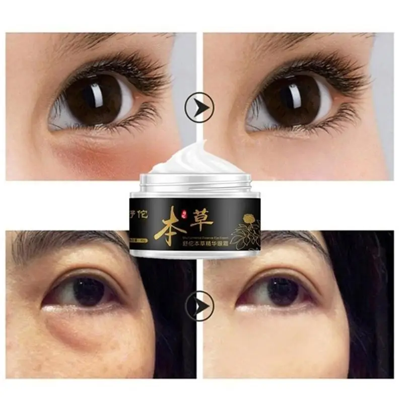 

Eye Cream Skin Care Reduces Fine Lines Relieve Dark Circles Face Cream Anti-Aging H8P7