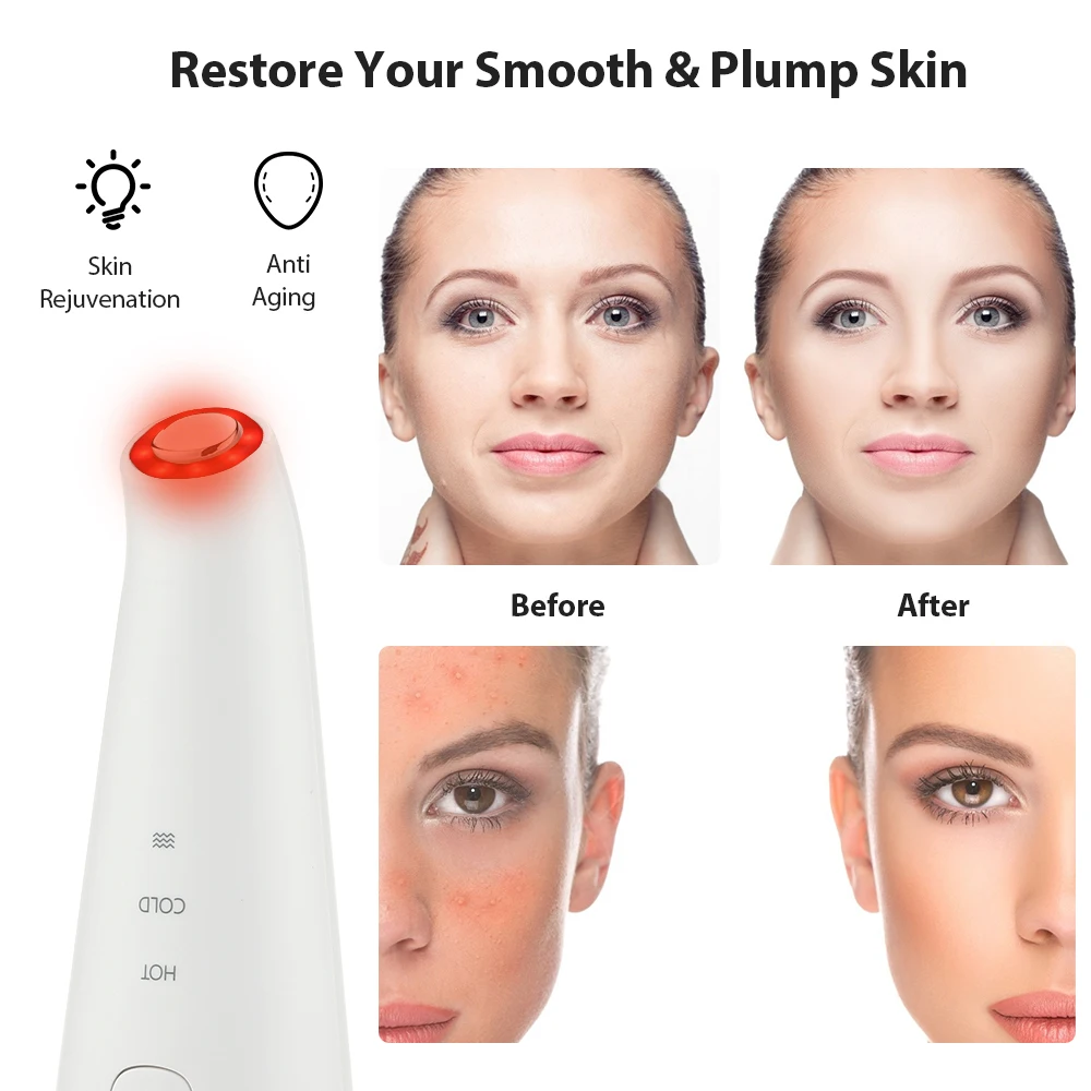 

LED Photon Therapy Skin Rejuvenation Sonic Vibration Wrinkle Remover Hot Cool Treatment Anti Aging Care Facial Massage