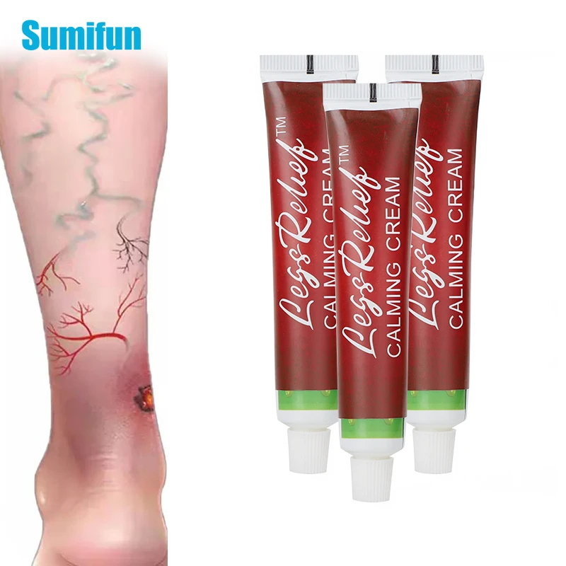 

20g Varicose Veins Ointmnet Vasculitis Phlebitis Spider Cream Varicosity Angiitis Removal Herbal Medical Plaster Health Care