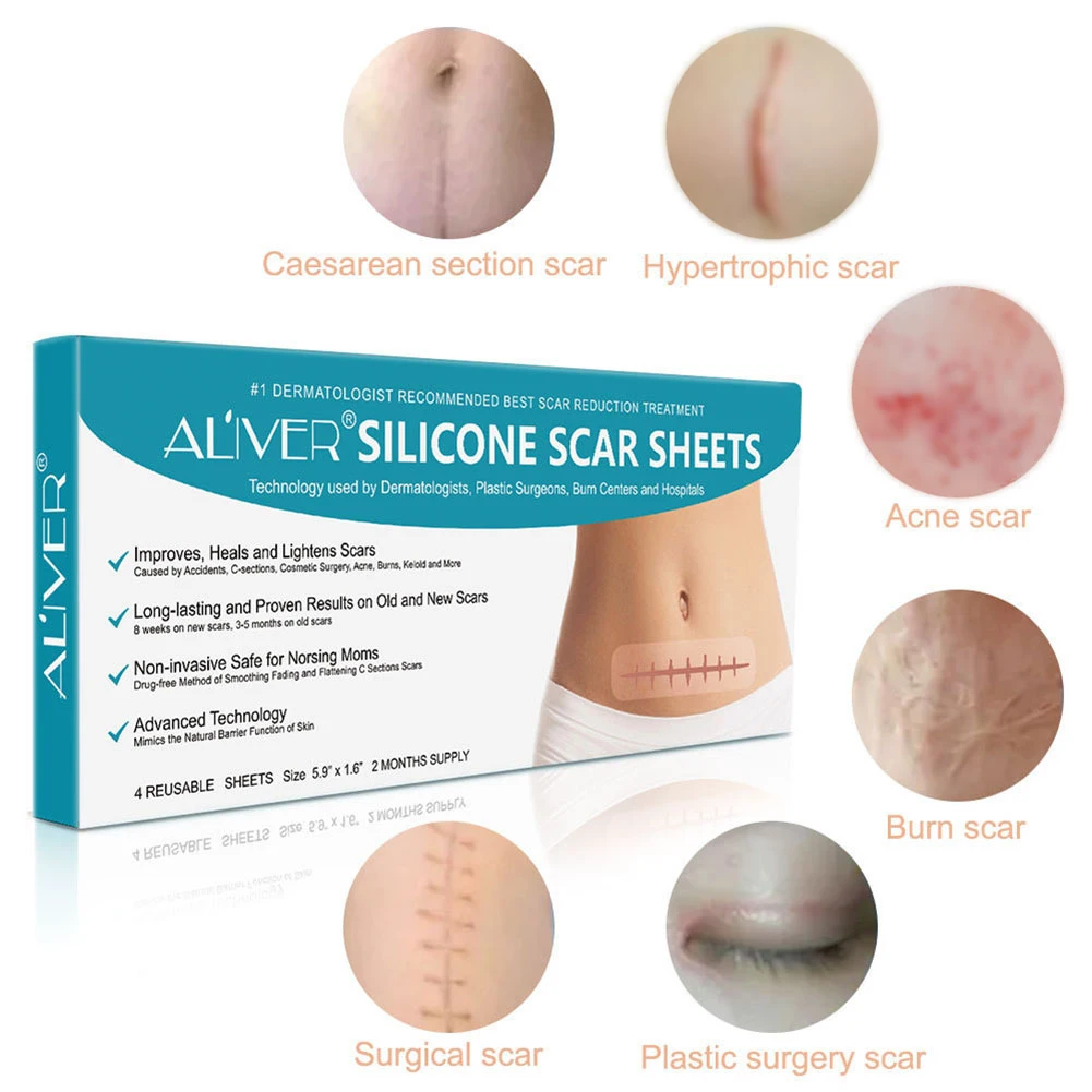 Safe Scar Removal Sticker Acne Non-toxic Skin-friendly Practical Therapy Delicate Design Long-lasting Plaster Set | Красота и