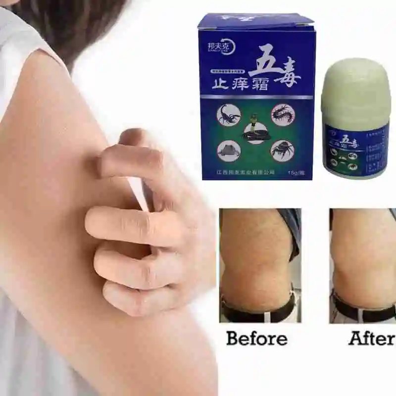 

15g Scorpion Venom Skin Itching And Infect Cream Dermatitis Treatment Ointment Herbal Antifungal Eczema Dermatitis Skin Care