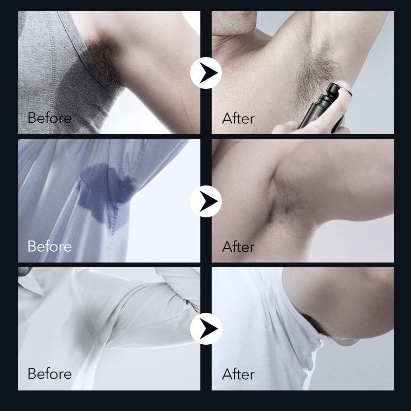 Мужские подмышки пота мяч тела одноразовые прокладки для подмышек дезодорант