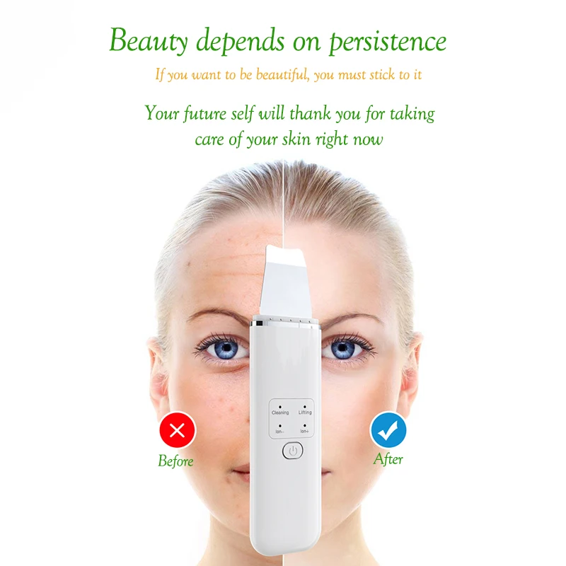 AbbasHealth перезаряжаемый ультразвуковой скраб для кожи лица Электрический