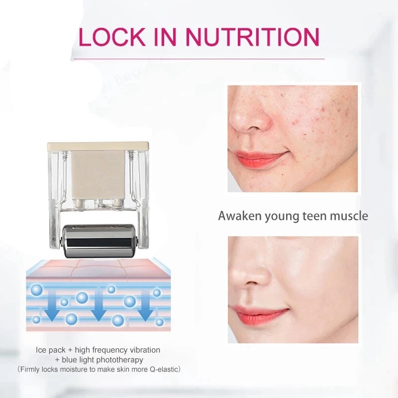 Koop Ems Facial Massager Mini Huidige Gezicht Massager Sonic Trillingen Rimpel Remover Hot Cool Ultra Sonic Gezicht Lifting Apparaat