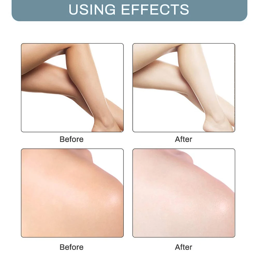Body Creams Armpit Whitening Cream Between Legs Knees Private Parts Formula Whitener Intimate Bleach Bellezon |
