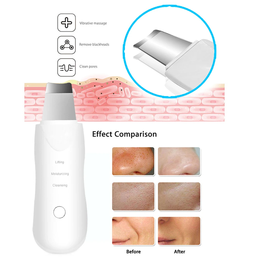 

USB charge Facial Massage Facial Cleansing Peeling Pore Cleaner Skin Scrubber EMS Ultrasonic Far Infrared Face Skin Body Slimmin