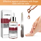 Жидкость для восстановления ногтей, пилка для осветления ногтей, анти-удаление онихомикоза ногтей, грибок, уход за ногтями, TSLM1
