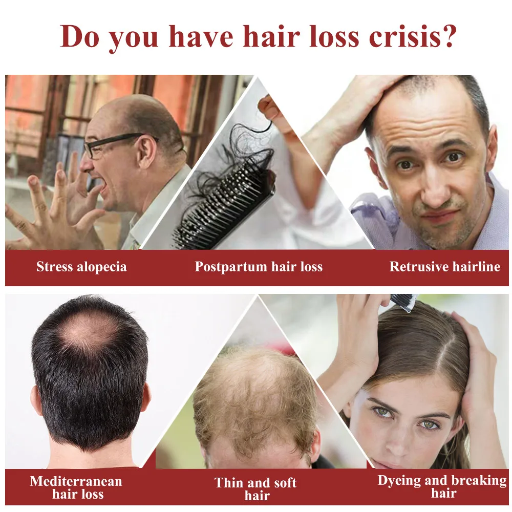 2 шт. сывороточная эссенция для быстрого роста волос масло против выпадения уход