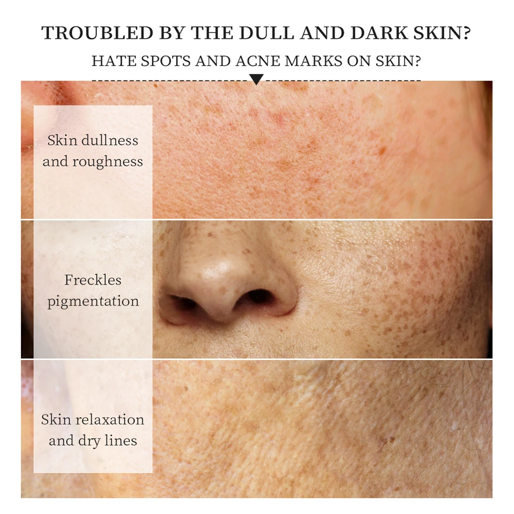 Отбеливающая укрепляющая маска с витамином С увлажнение против морщин сужение