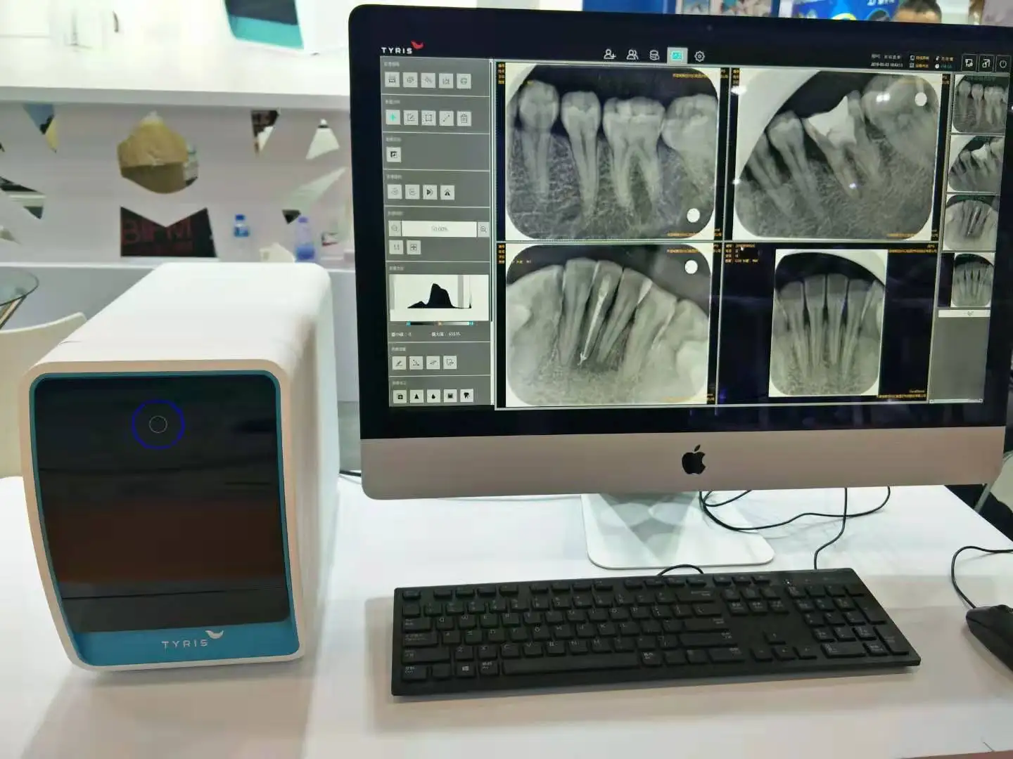 

TR- 120 Digital Dental Image Plate Scanner Dental Scanner