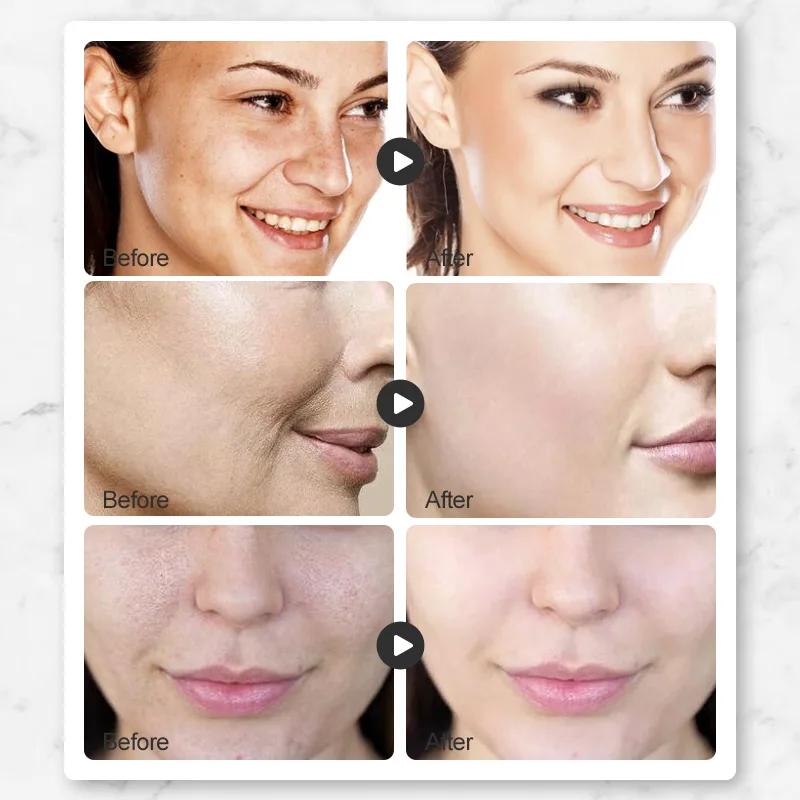 Darali 5g * 7 многожильный эффекта увлажнения класса люкс для лица ночная маска на