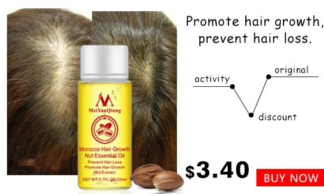 New Arrival Andrea Hair Growth Products Ginger Oil Faster Grow Stop Loss Treatment | Красота и здоровье