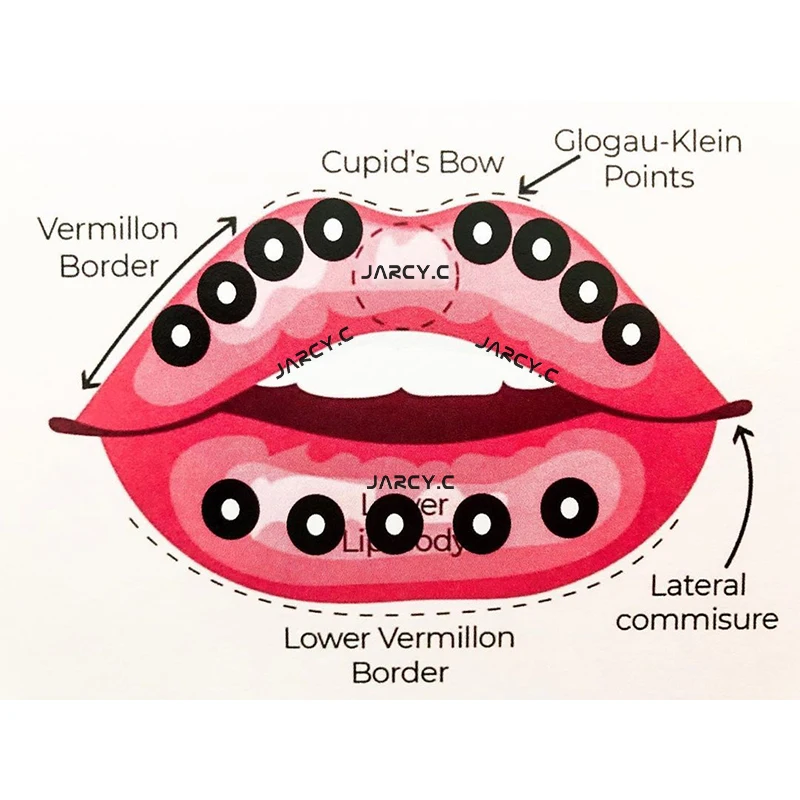 

Hot 2ml/5ml/10ml Lips Enhancement Hyaluronic Acid with Box