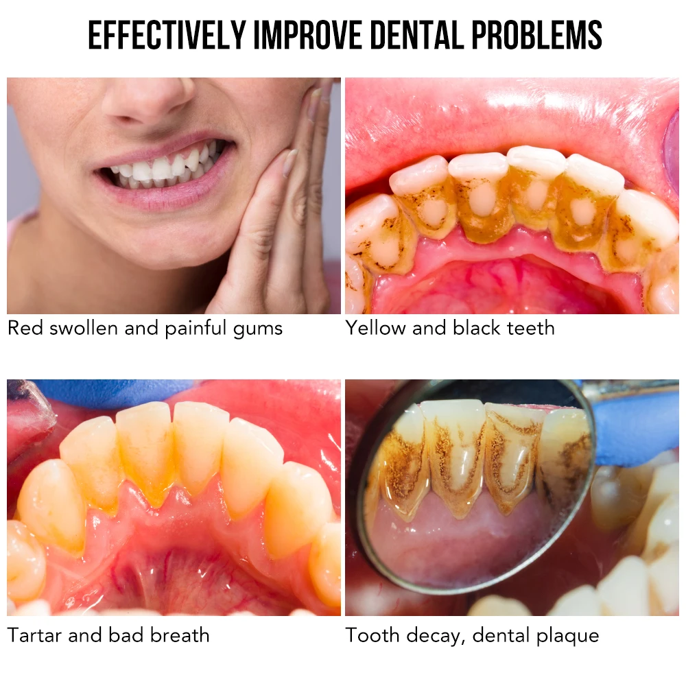 Ультразвуковой очиститель зубов Визуальный Электрический Очиститель средство