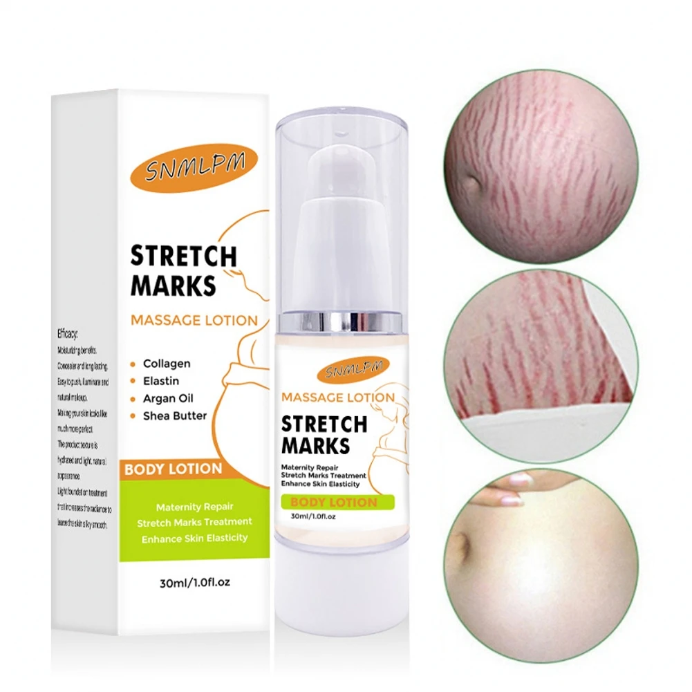 30ml Remove Stretch Marks Cream Anti Aging Anti Wrinkle Maternity Skin Repair Remove Pregnancy Scars Treatment Body Skin Care