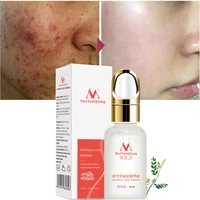 meiyanqiong anti acne face serum acne removal shrink pores oil control moisturizing essence whitening brightening facial care