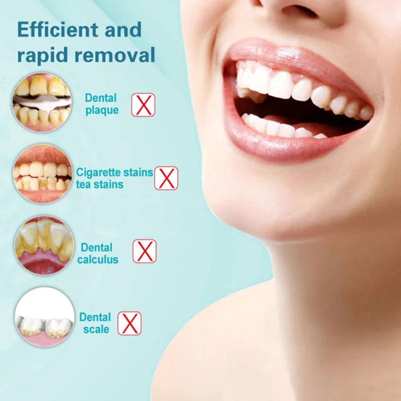 

Electric Tartar Remover Teeth Whitening Cleaning Dental Tartar Scraper Tooth Polisher Stain Eraser High Frequency Vibration