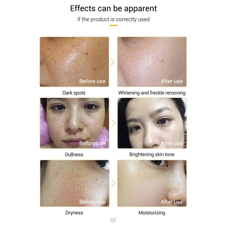 Витаминная с Сыворотка для лица гиалуроновой кислотой лучший антивозрастной