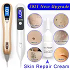 Лазерная ручка для удаления родинок, 2021 г., набор для удаления бородавок, плазмы, восстановления, ухода за кожей, удаления пор, веснушек, темных пятен, татуировок