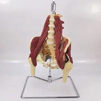 11 lumbar vertebrae with vital muscles pelvic muscle model vertebrae pelvis spineskeleton protrusion of intervertebral disc