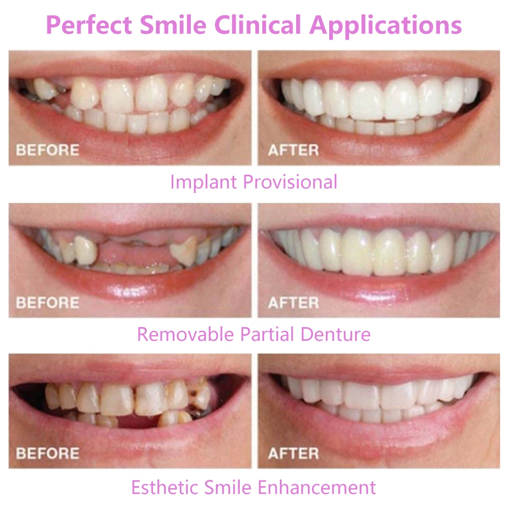 

Cosmetic Denture Upper/Lower Snap on Smile Polyethylene Instant Veneers Fake Teeth Cover Simulation Braces Oral Care Beauty Tool