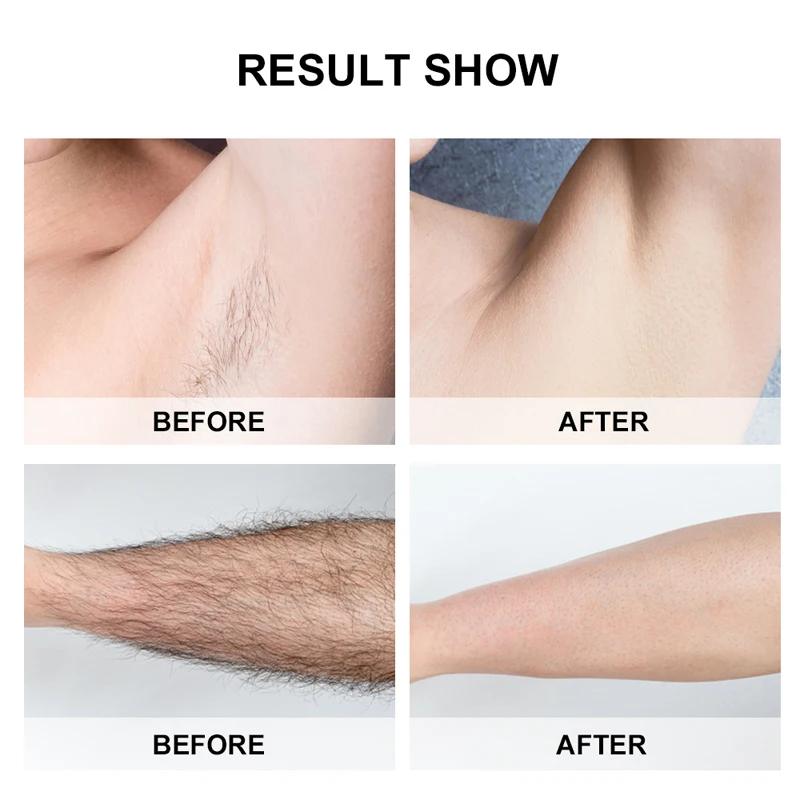

Home IPL Laser Hair Removal Instrument OEM Custom Painless Full Body Portable Permanent Unisex Photoepilator Hair Removal Device